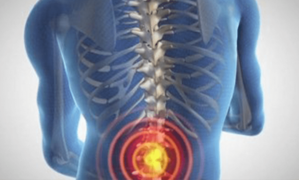 Graphic Showing A Person With Lower Back Pain