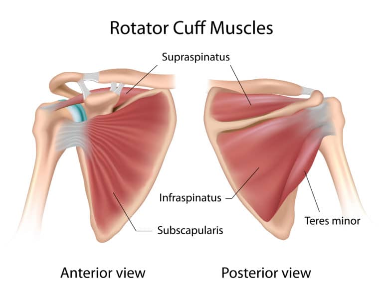 Treatment Options for Rotator Cuff Tears - The Orthopaedic Institute